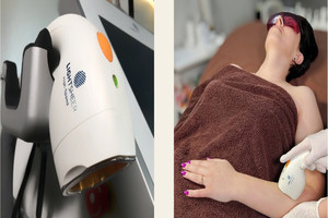 Идеальный курс лазерной эпиляции